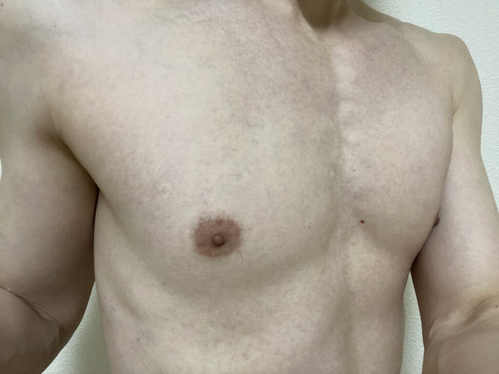 男の全身脱毛5回目の効果
