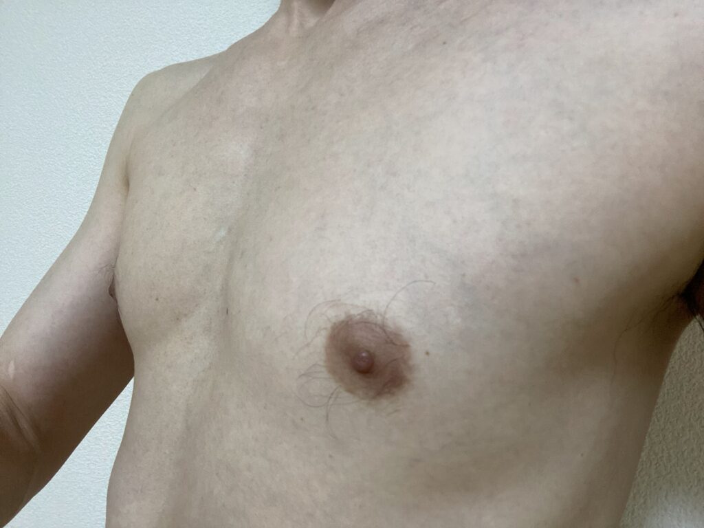 男の全身脱毛5回目の効果
