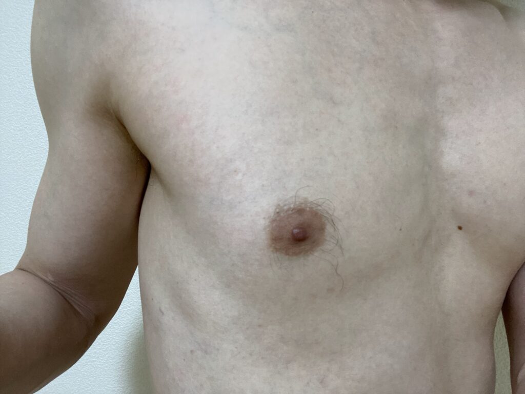 男の全身脱毛5回目の効果