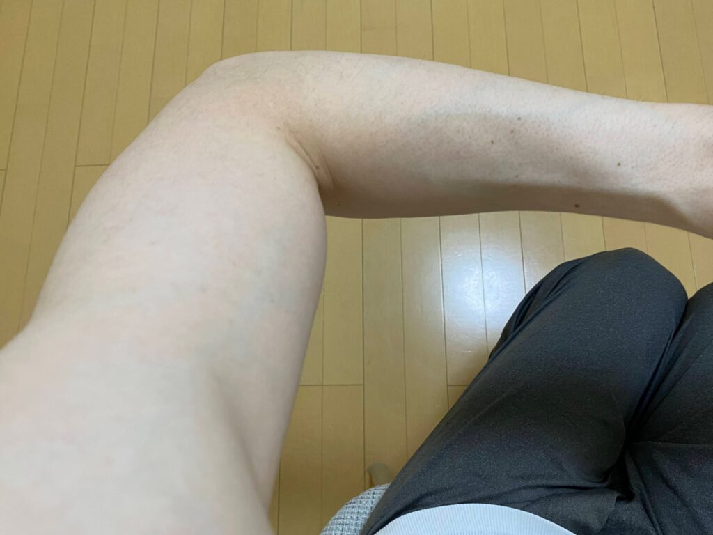 全身脱毛5回目の効果