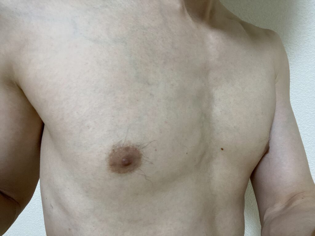 男の全身脱毛5回目の効果